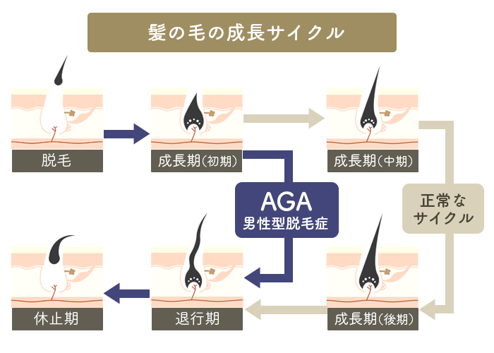 AGA（男性型脱毛症）の髪の毛の成長サイクル