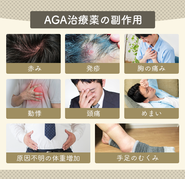 AGA治療薬の副作用