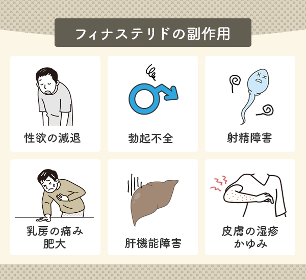 フィナステリドの副作用であらわれる一般的な症状