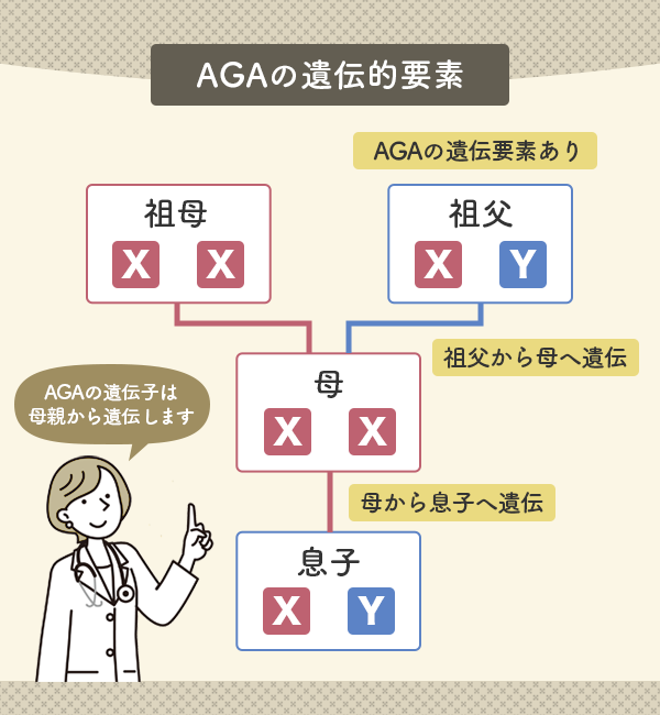 AGAの遺伝的要素