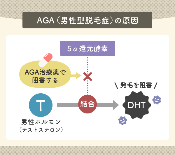 DHTが毛根に悪影響を及ぼすことを抑えるには専門的なAGA治療が必要