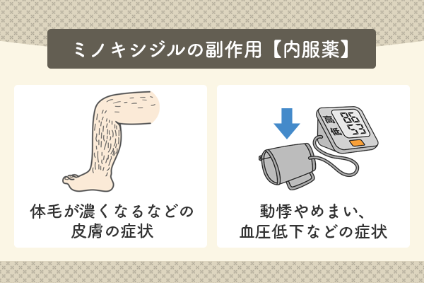 ミノキシジル内服薬の副作用